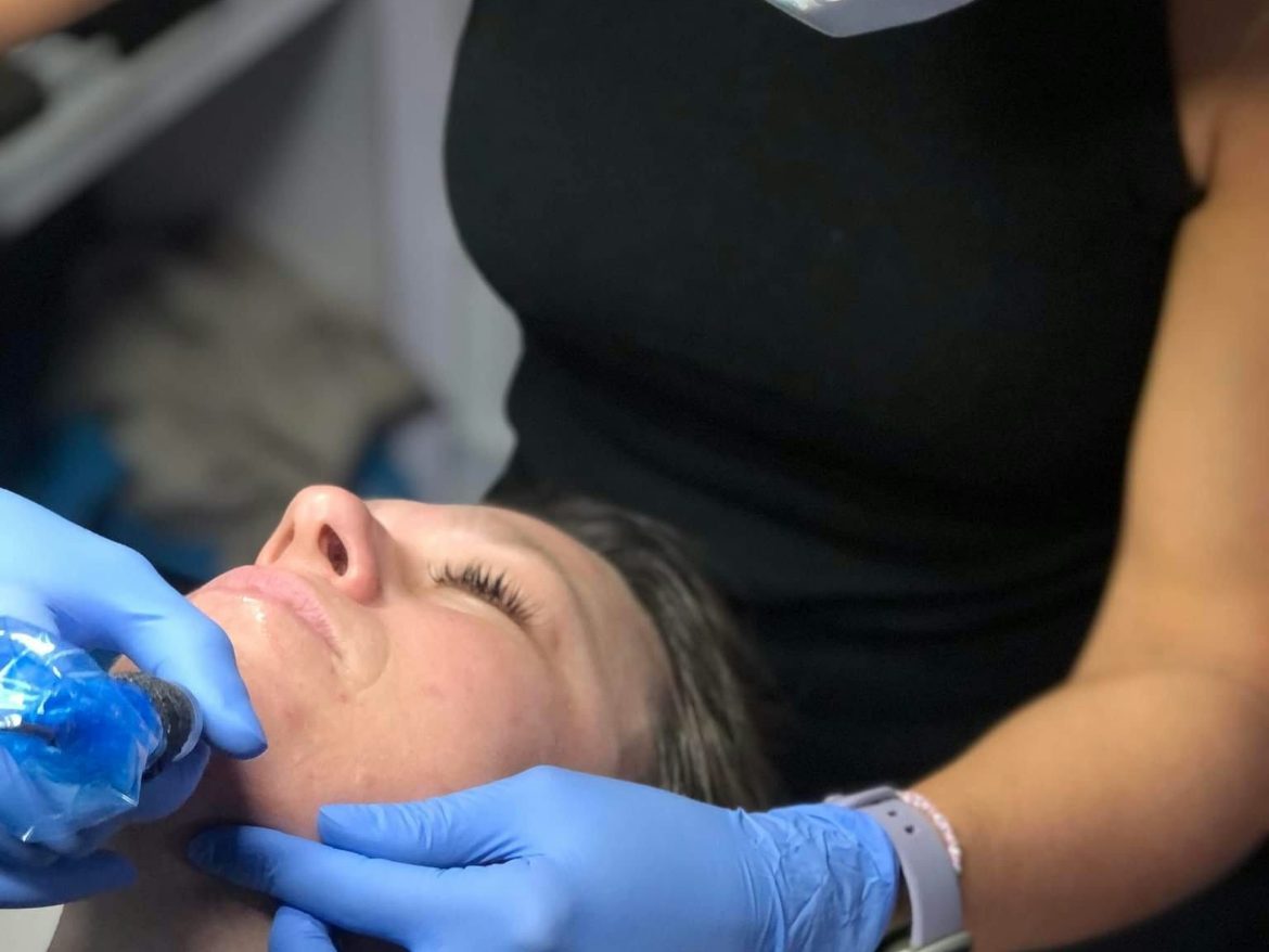 Un microneedling du visage à la clinique